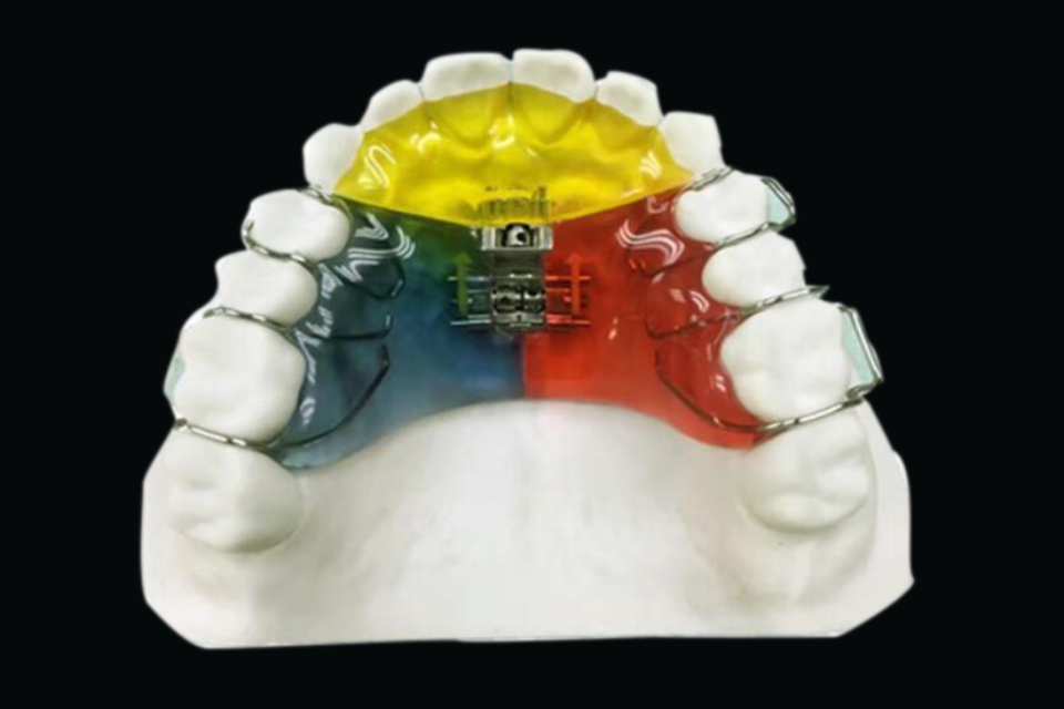 China Dental Lab, Dental Lab in China,Best Dental Lab in China