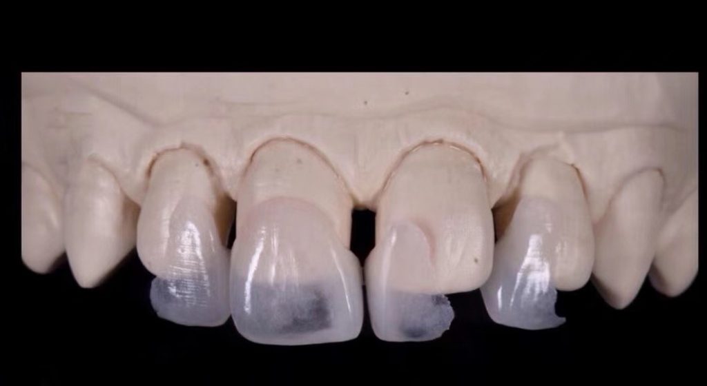 China Dental Lab, Dental Lab in China,Best Dental Lab in China