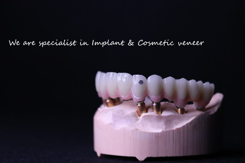 your trusted top-notch China Dental Lab. Our cutting-edge facility and skilled team deliver exceptional dental restorations focusing on aesthetics and precision. Explore our comprehensive solutions and elevate your dental practice to new heights. Delivery the top-notch quality is our main concern.