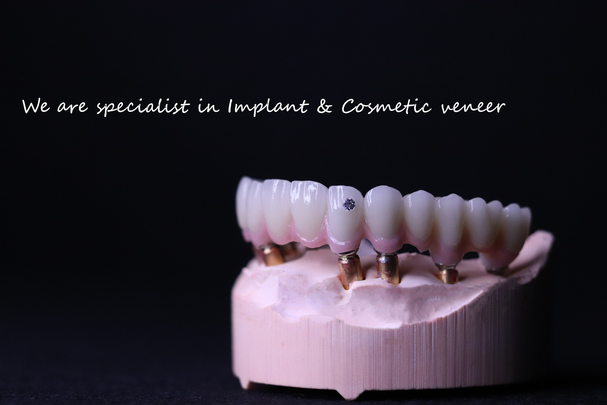 your trusted top-notch China Dental Lab. Our cutting-edge facility and skilled team deliver exceptional dental restorations focusing on aesthetics and precision. Explore our comprehensive solutions and elevate your dental practice to new heights. Delivery the top-notch quality is our main concern.