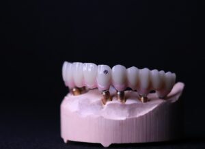 China Dental Lab, Dental Lab in China,Best Dental Lab in China