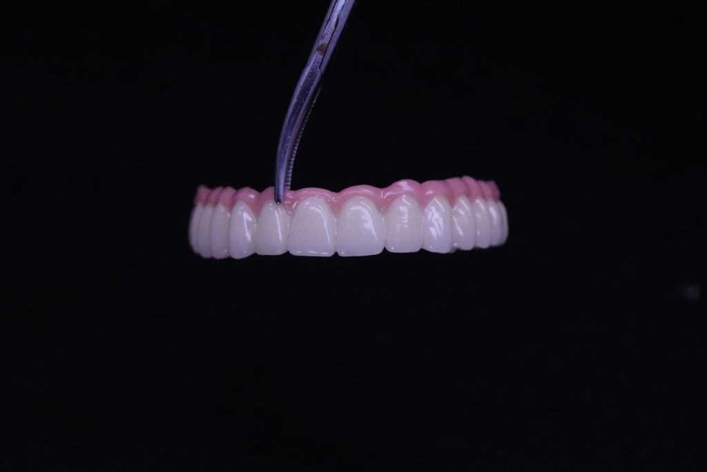 China Dental Lab, Dental Lab in China,Best Dental Lab in China