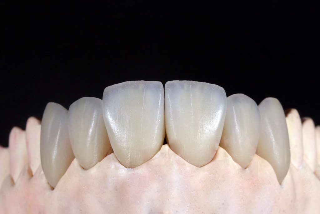 China Dental Lab, Dental Lab in China,Best Dental Lab in China