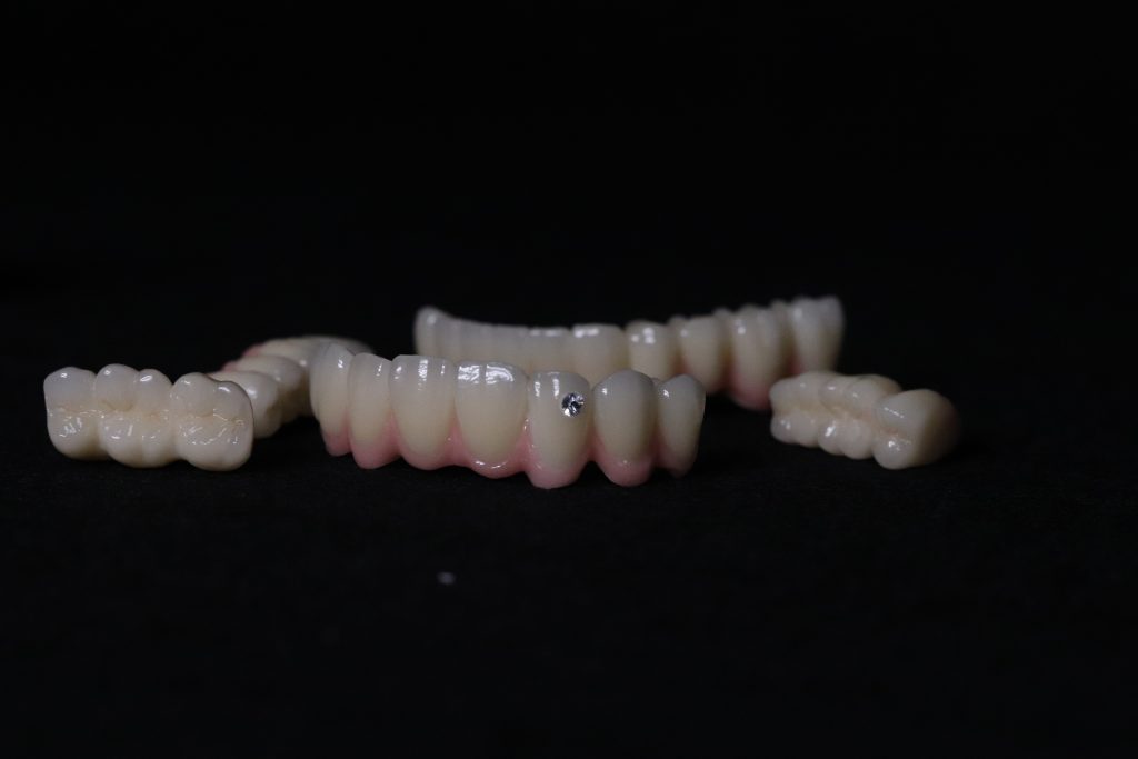 China Dental Lab, Dental Lab in China,Best Dental Lab in China