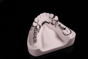 Cobalt chrome framework