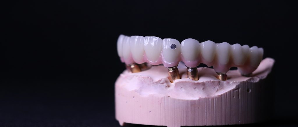 China Dental Lab, Dental Lab in China,Best Dental Lab in China