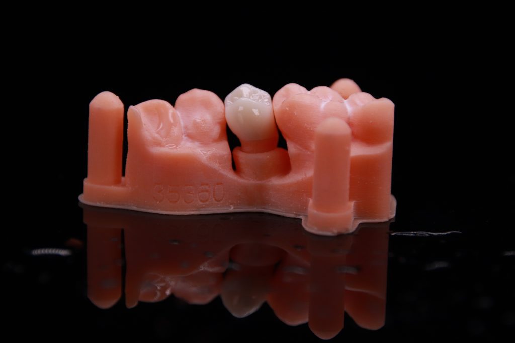 Digital zirconia crown China Dental Lab