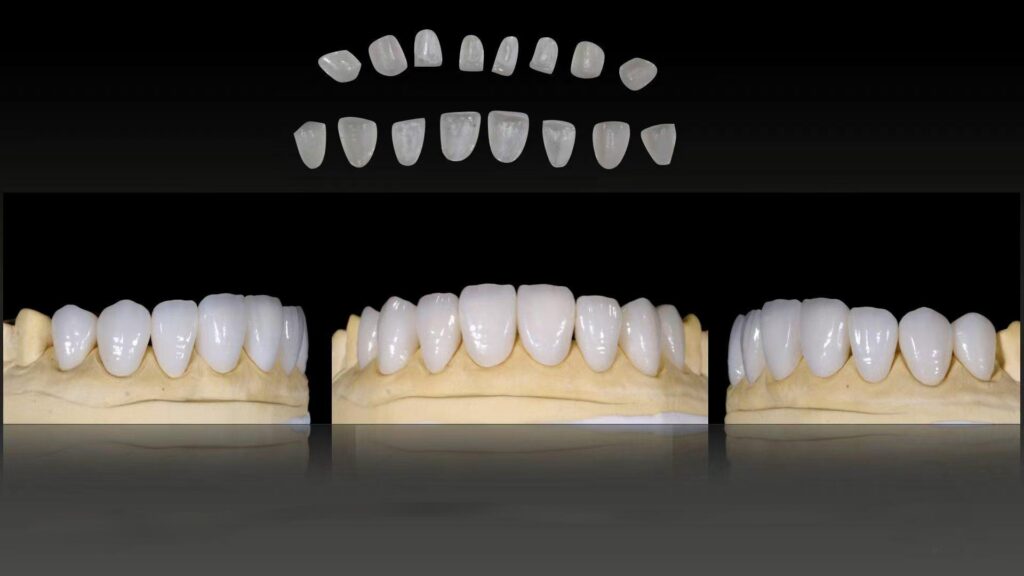 China Dental lab Dental Lab China